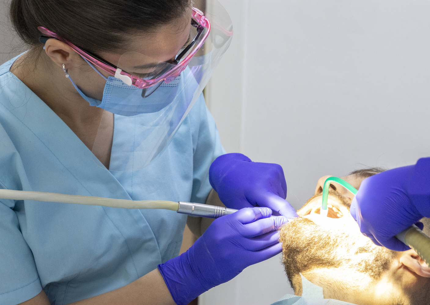 Costul și opțiunile pentru lucrările dentare